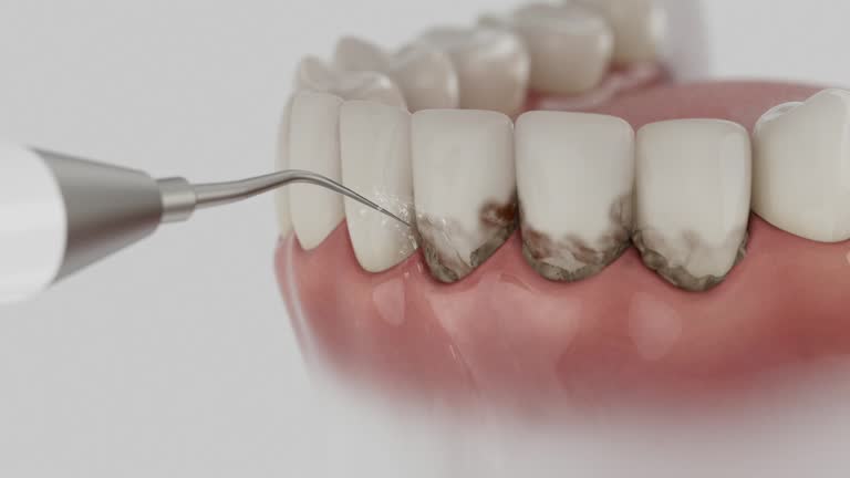 Reliable Tooth Extraction contractor in Copperas Cove, TX by Smile Center Dentistry